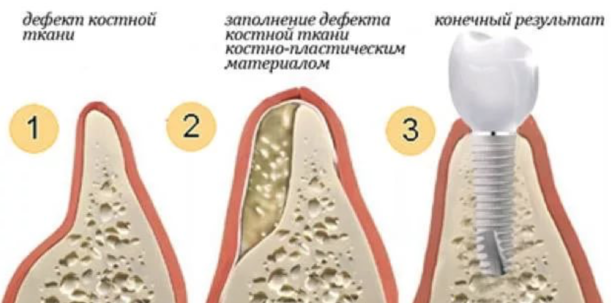 Как логан потерял регенерацию